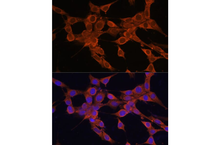 Immunofluorescence - Anti-Bax Antibody (A88735) - Antibodies.com