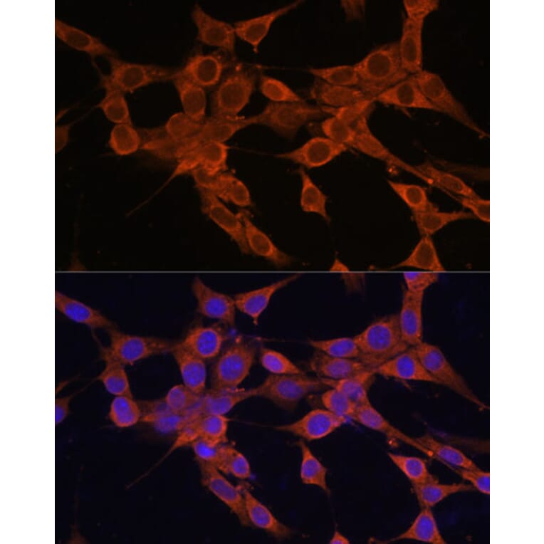 Immunofluorescence - Anti-Bax Antibody (A88735) - Antibodies.com