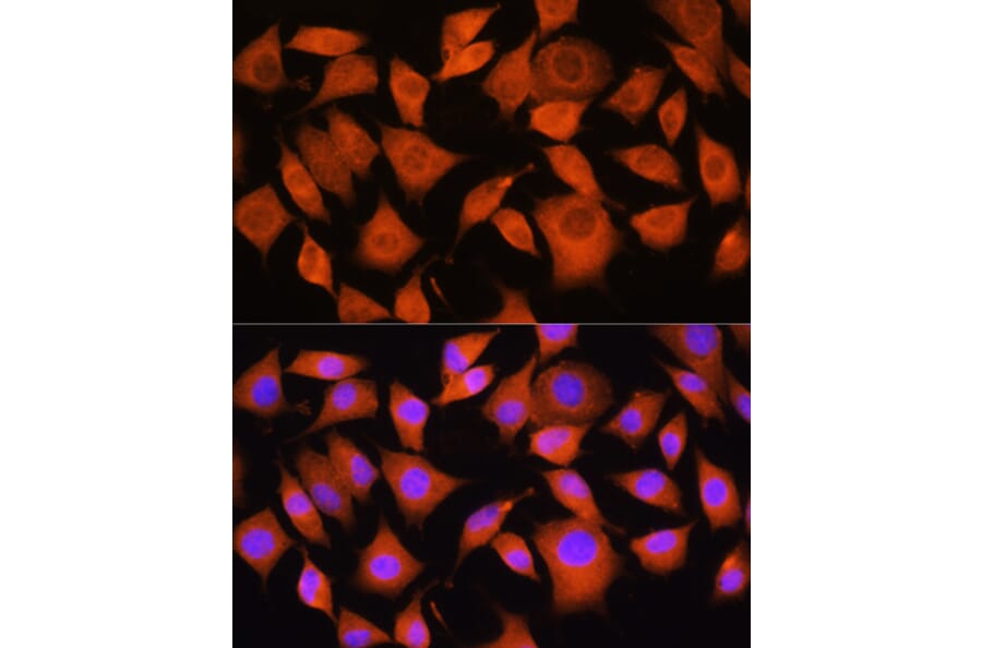 Immunofluorescence - Anti-Bax Antibody (A88735) - Antibodies.com