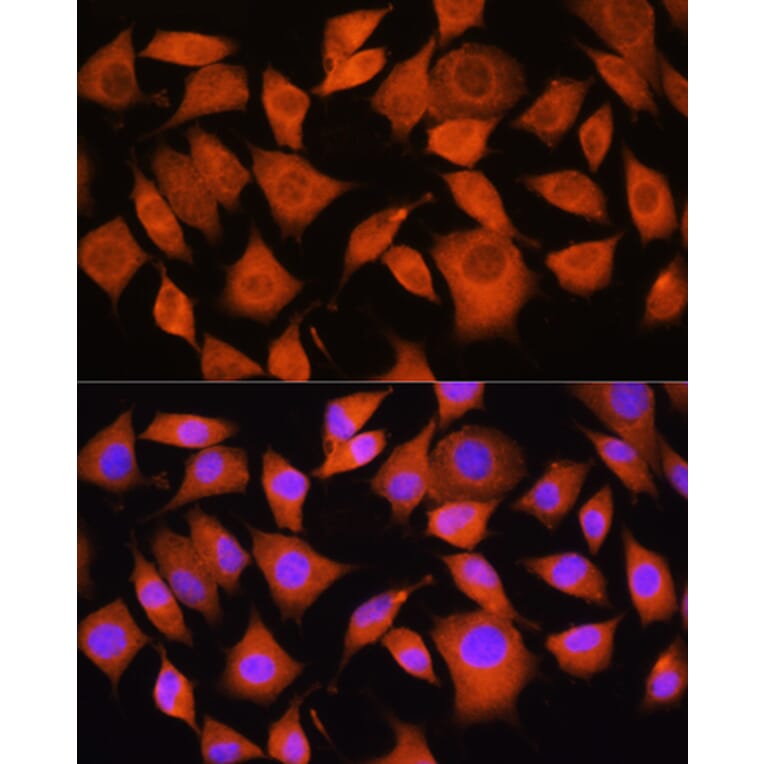Immunofluorescence - Anti-Bax Antibody (A88735) - Antibodies.com