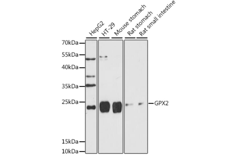 Western Blot - Anti-Glutathione Peroxidase 2/GPX2 Antibody (A88736) - Antibodies.com