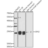Western Blot - Anti-Glutathione Peroxidase 2/GPX2 Antibody (A88736) - Antibodies.com