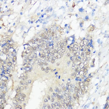 glutathione peroxidase 2 antibody Anti-Glutathione Peroxidase 2/GPX2 Antibody (A88736)