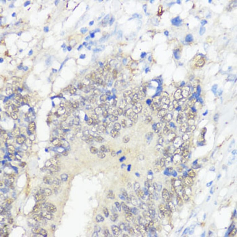 Immunohistochemistry - Anti-Glutathione Peroxidase 2/GPX2 Antibody (A88736) - Antibodies.com