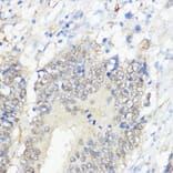 Immunohistochemistry - Anti-Glutathione Peroxidase 2/GPX2 Antibody (A88736) - Antibodies.com