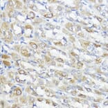 Immunohistochemistry - Anti-Glutathione Peroxidase 2/GPX2 Antibody (A88736) - Antibodies.com