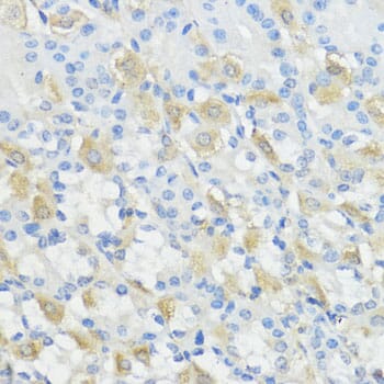 glutathione peroxidase 2 antibody Anti-Glutathione Peroxidase 2/GPX2 Antibody (A88736)