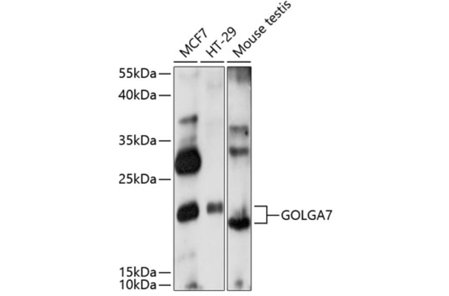 Western Blot - Anti-GOLGA7 Antibody (A88737) - Antibodies.com