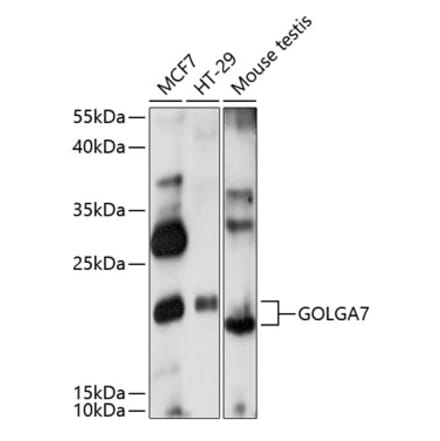 Western Blot - Anti-GOLGA7 Antibody (A88737) - Antibodies.com
