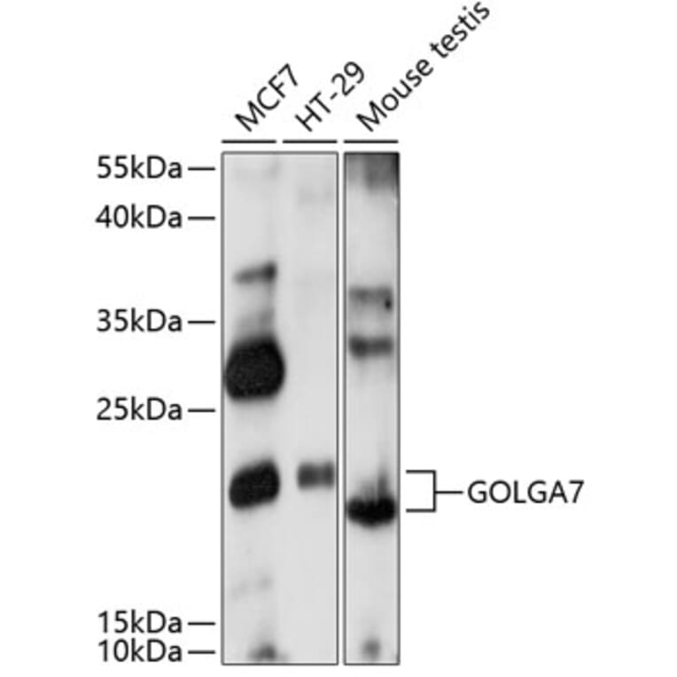 Western Blot - Anti-GOLGA7 Antibody (A88737) - Antibodies.com