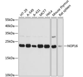 Western Blot - Anti-HSPC111 Antibody (A88738) - Antibodies.com