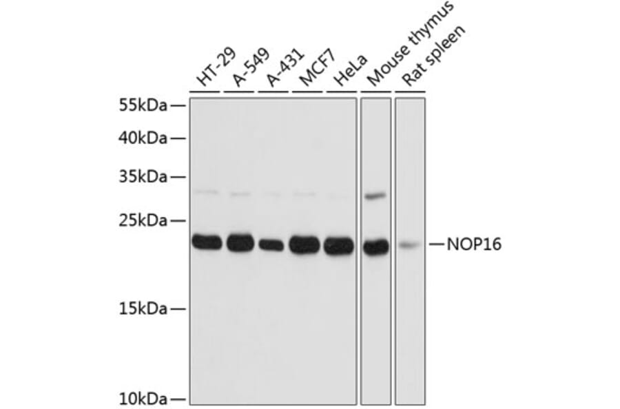 Western Blot - Anti-HSPC111 Antibody (A88738) - Antibodies.com