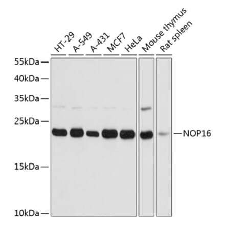 Western Blot - Anti-HSPC111 Antibody (A88738) - Antibodies.com