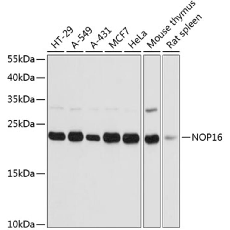 Western Blot - Anti-HSPC111 Antibody (A88738) - Antibodies.com