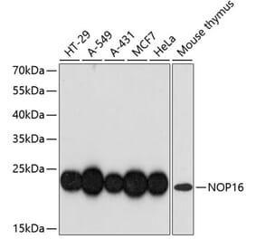Western Blot - Anti-HSPC111 Antibody (A88739) - Antibodies.com
