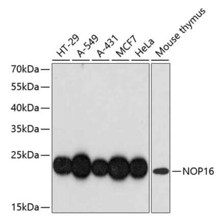 Western Blot - Anti-HSPC111 Antibody (A88739) - Antibodies.com