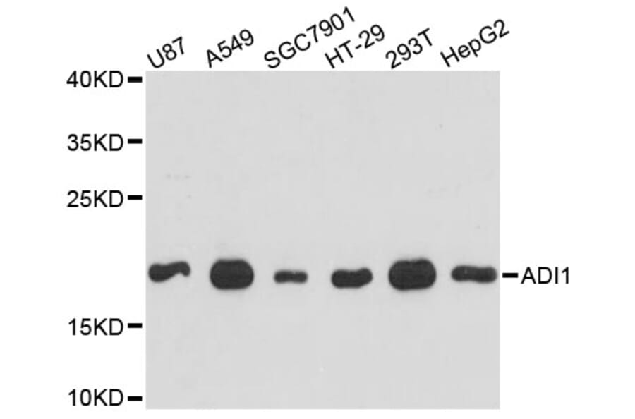 Western Blot - Anti-ADI1 Antibody (A4820) - Antibodies.com