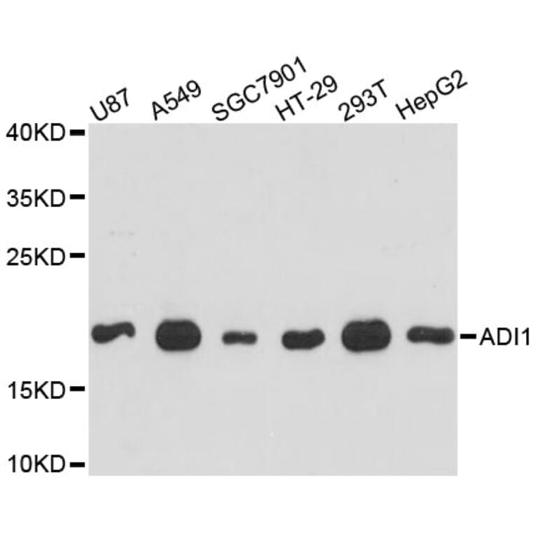 Western Blot - Anti-ADI1 Antibody (A4820) - Antibodies.com