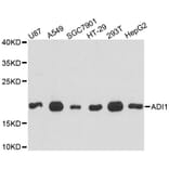 Western Blot - Anti-ADI1 Antibody (A4820) - Antibodies.com