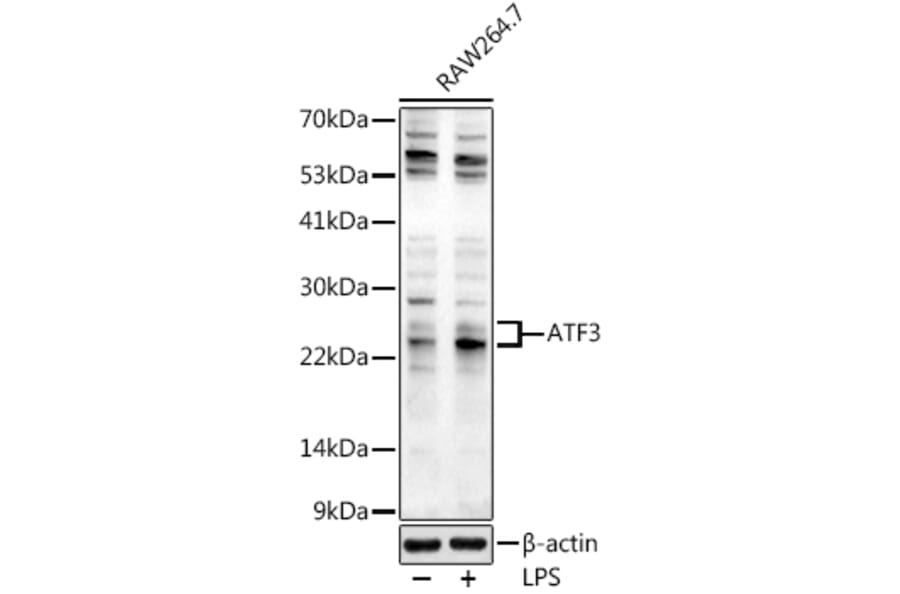 Western Blot - Anti-ATF3 Antibody (A88741) - Antibodies.com