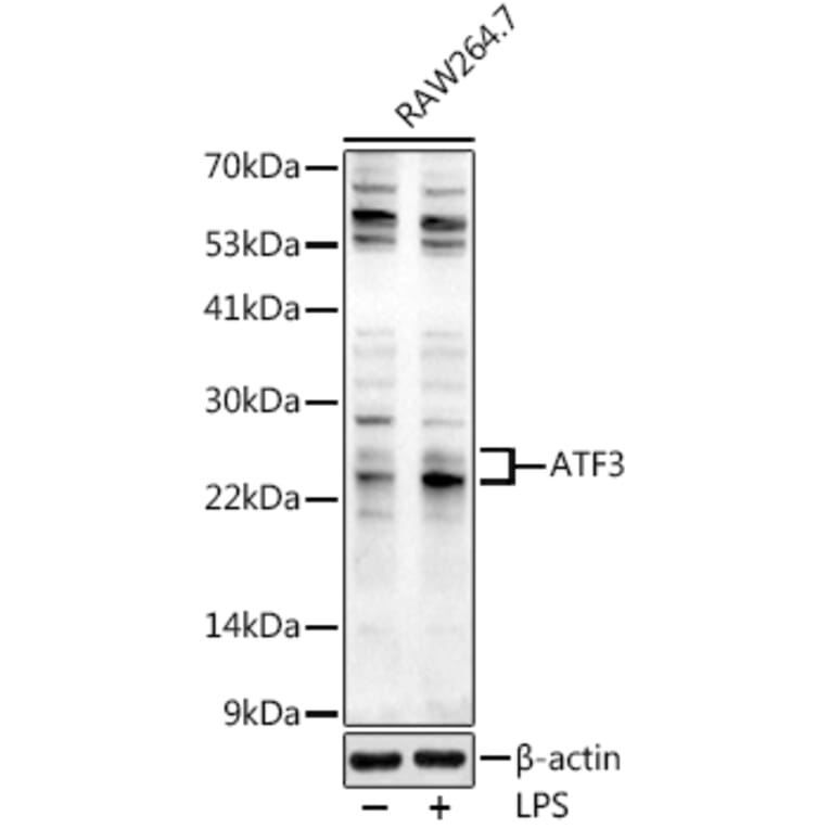 Western Blot - Anti-ATF3 Antibody (A88741) - Antibodies.com