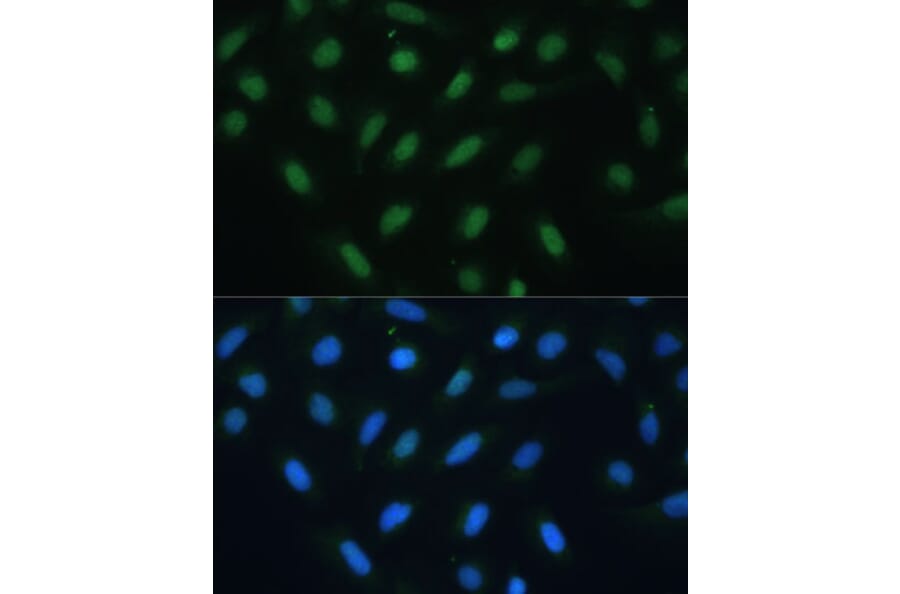 Immunofluorescence - Anti-ATF3 Antibody (A88741) - Antibodies.com