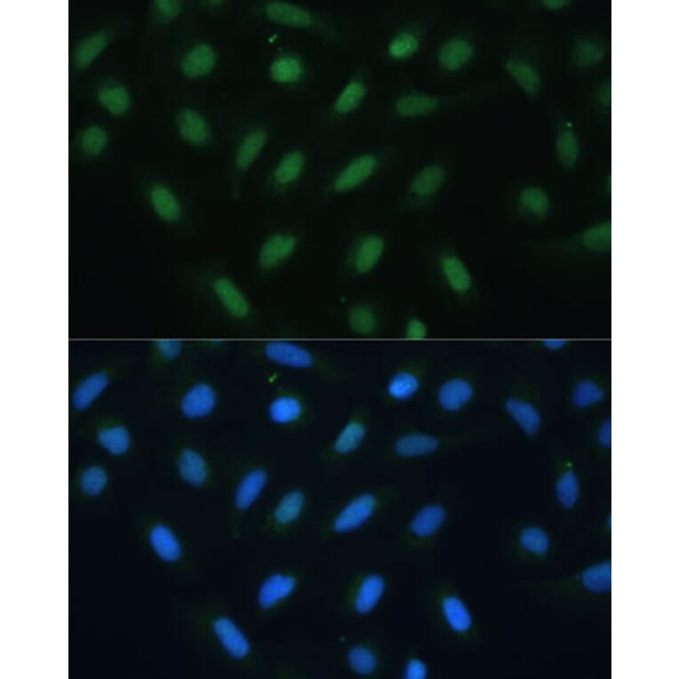 Immunofluorescence - Anti-ATF3 Antibody (A88741) - Antibodies.com