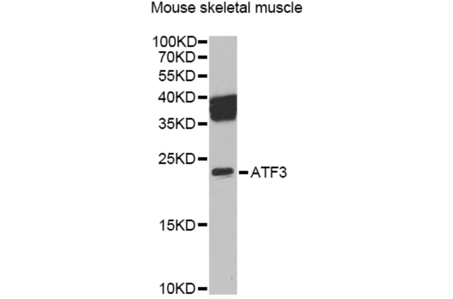Western Blot - Anti-ATF3 Antibody (A13470) - Antibodies.com