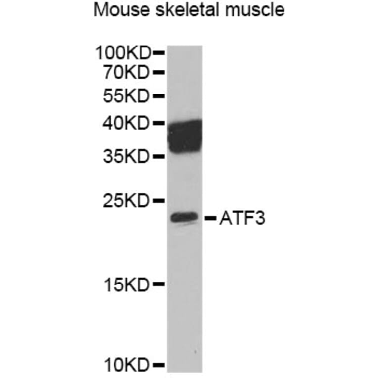 Western Blot - Anti-ATF3 Antibody (A13470) - Antibodies.com