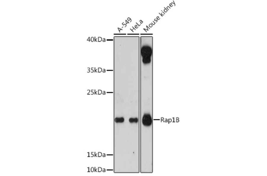 Western Blot - Anti-RAP1B Antibody (A88743) - Antibodies.com