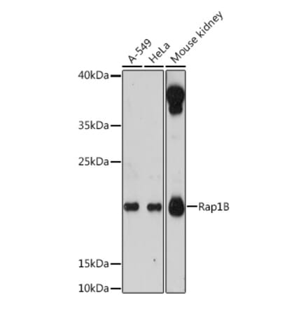 Western Blot - Anti-RAP1B Antibody (A88743) - Antibodies.com