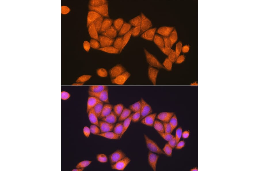 Immunofluorescence - Anti-RAP1B Antibody (A88743) - Antibodies.com
