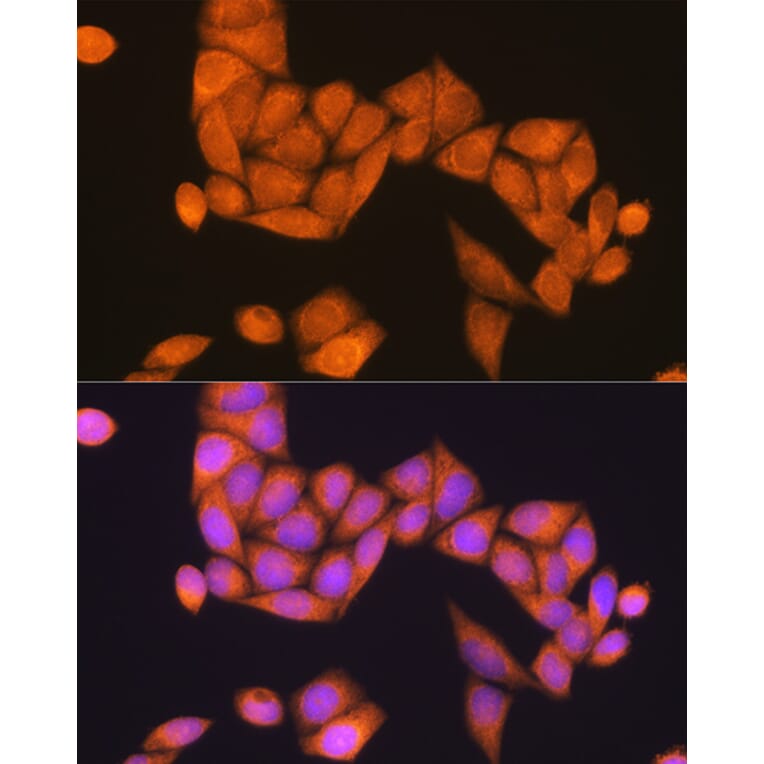 Immunofluorescence - Anti-RAP1B Antibody (A88743) - Antibodies.com