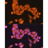 Immunofluorescence - Anti-RAP1B Antibody (A88743) - Antibodies.com