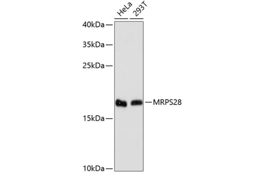 Western Blot - Anti-MRPS28 Antibody (A88744) - Antibodies.com