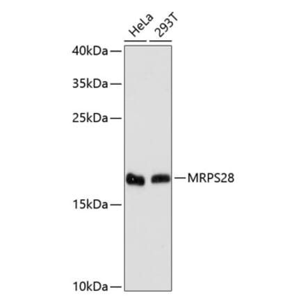 Western Blot - Anti-MRPS28 Antibody (A88744) - Antibodies.com