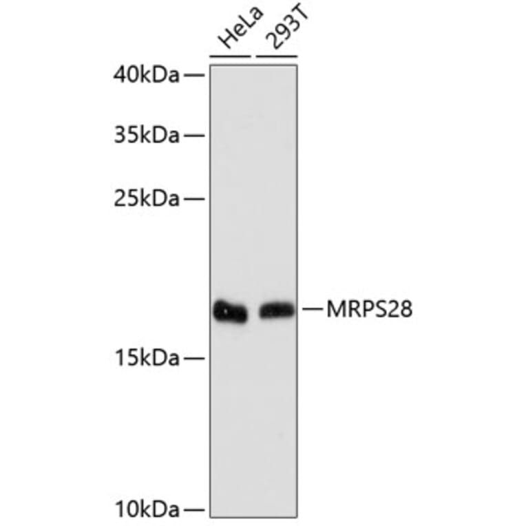 Western Blot - Anti-MRPS28 Antibody (A88744) - Antibodies.com