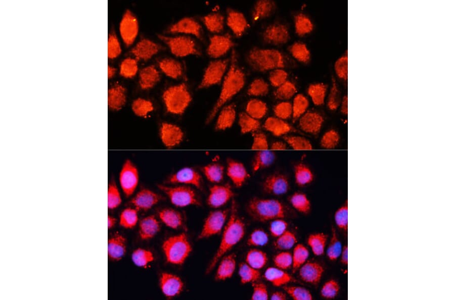 Immunofluorescence - Anti-MRPS28 Antibody (A88744) - Antibodies.com