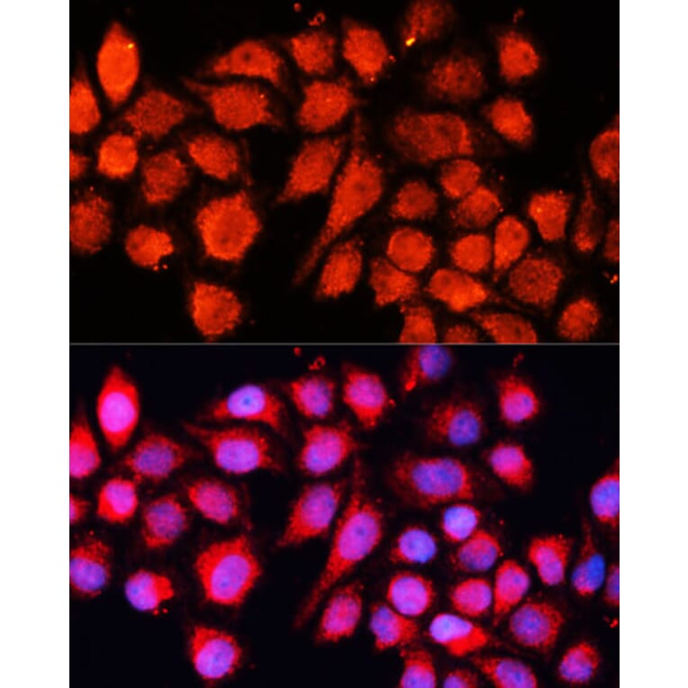 Immunofluorescence - Anti-MRPS28 Antibody (A88744) - Antibodies.com