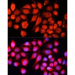 Immunofluorescence - Anti-MRPS28 Antibody (A88744) - Antibodies.com