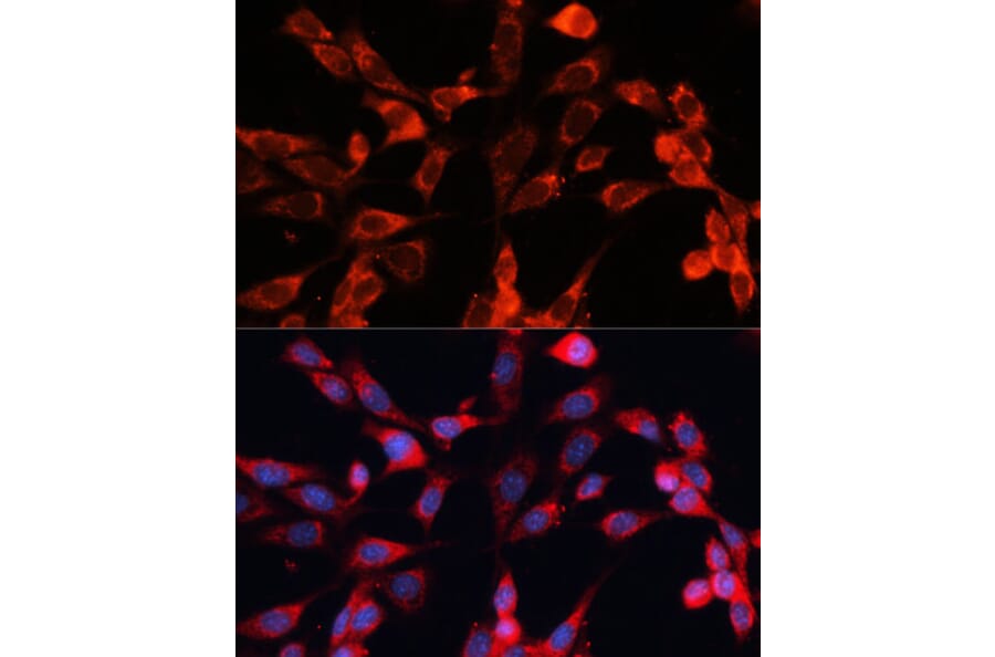Immunofluorescence - Anti-MRPS28 Antibody (A88744) - Antibodies.com