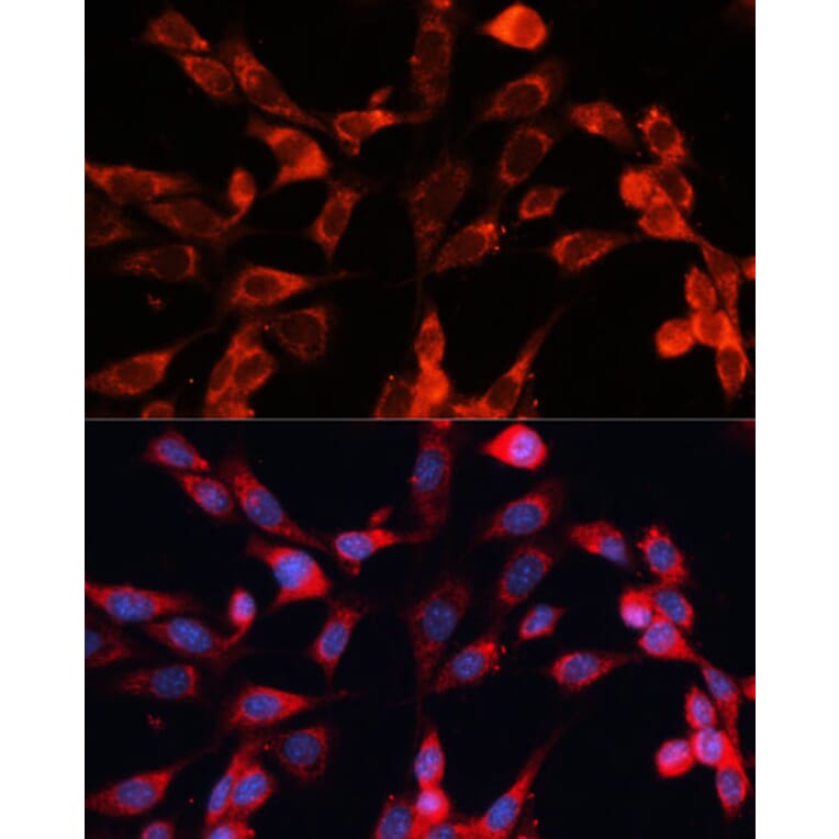 Immunofluorescence - Anti-MRPS28 Antibody (A88744) - Antibodies.com