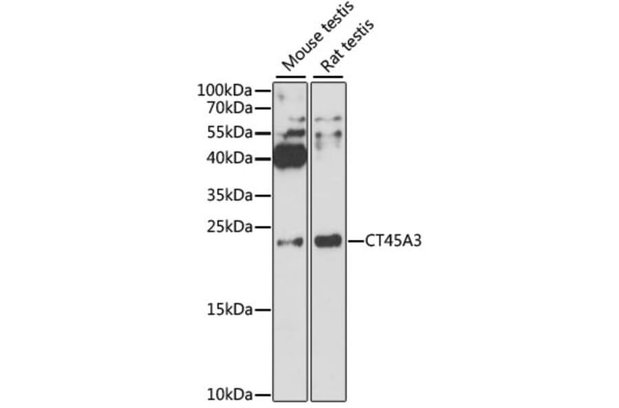 Western Blot - Anti-CT45A3 Antibody (A12887) - Antibodies.com