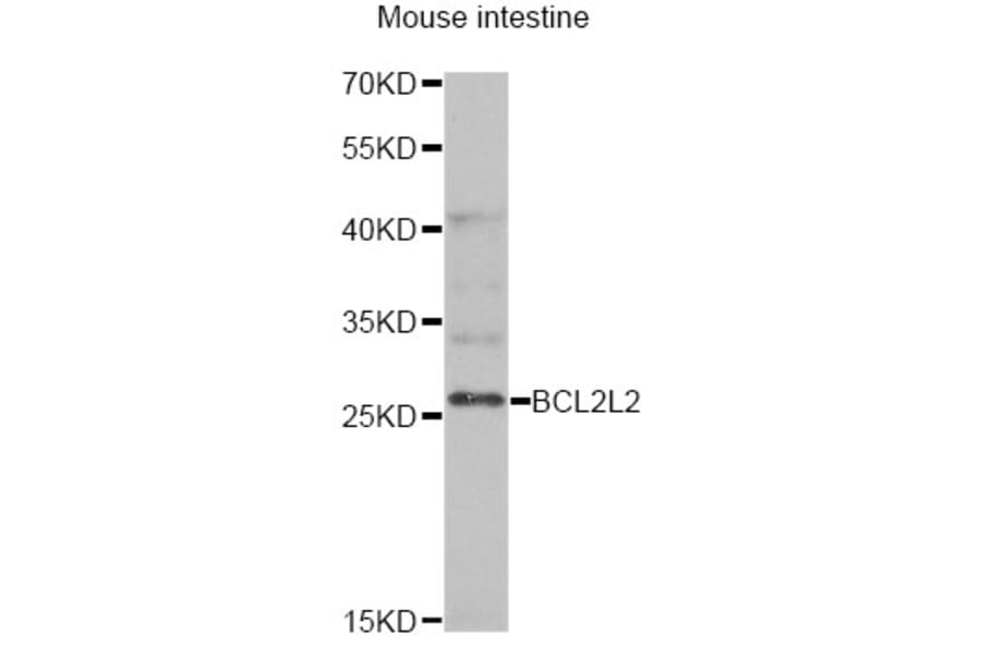 Western Blot - Anti-BCL2L2 Antibody (A13471) - Antibodies.com
