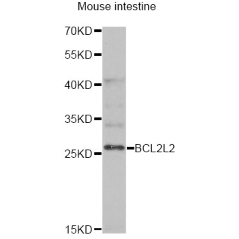Western Blot - Anti-BCL2L2 Antibody (A13471) - Antibodies.com