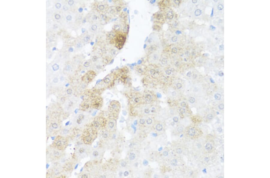 Immunohistochemistry - Anti-BCL2L2 Antibody (A13471) - Antibodies.com