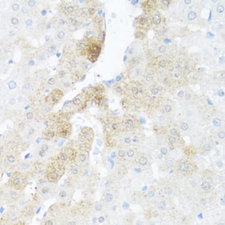 Immunohistochemistry - Anti-BCL2L2 Antibody (A13471) - Antibodies.com