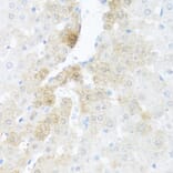 Immunohistochemistry - Anti-BCL2L2 Antibody (A13471) - Antibodies.com