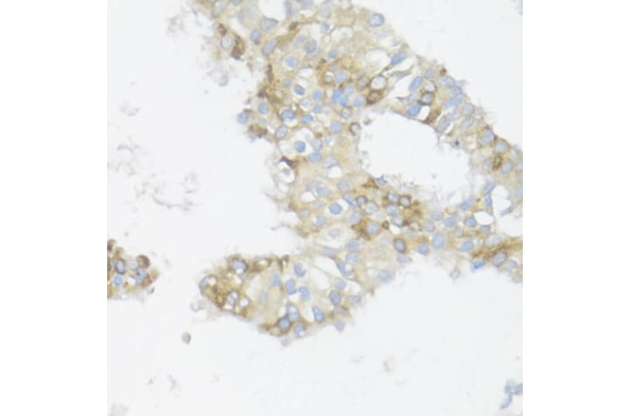 Immunohistochemistry - Anti-BCL2L2 Antibody (A13471) - Antibodies.com