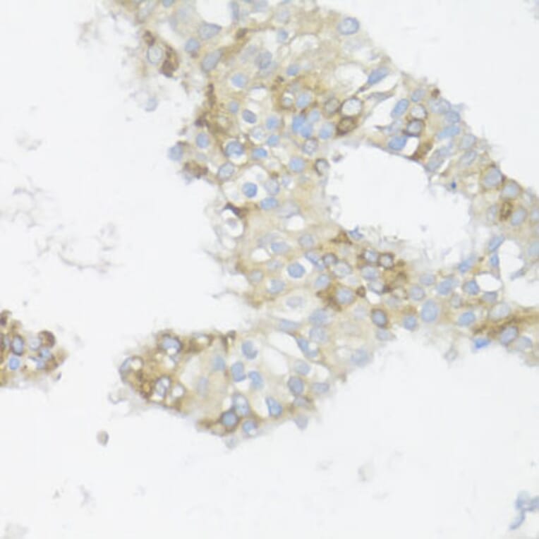 Immunohistochemistry - Anti-BCL2L2 Antibody (A13471) - Antibodies.com